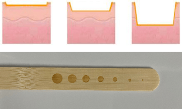 サージカルモード