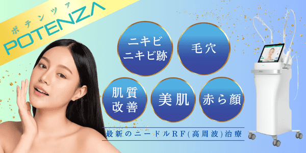 ポテンツァ